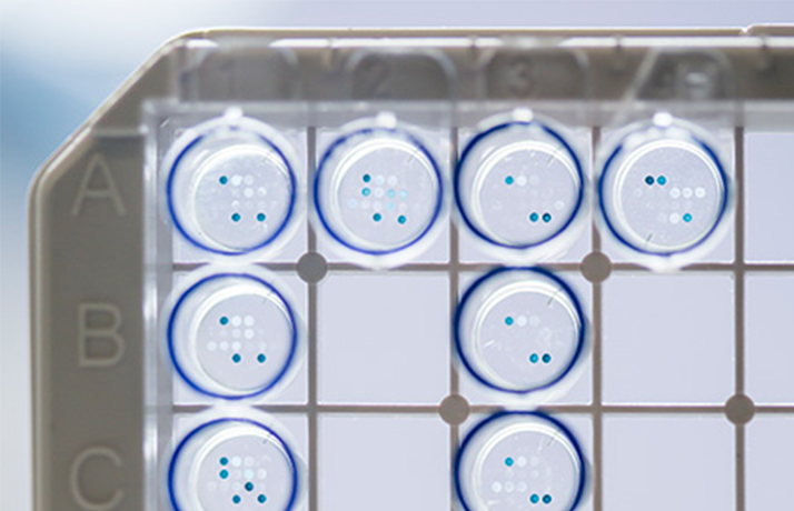 Seraspot borrelia plate